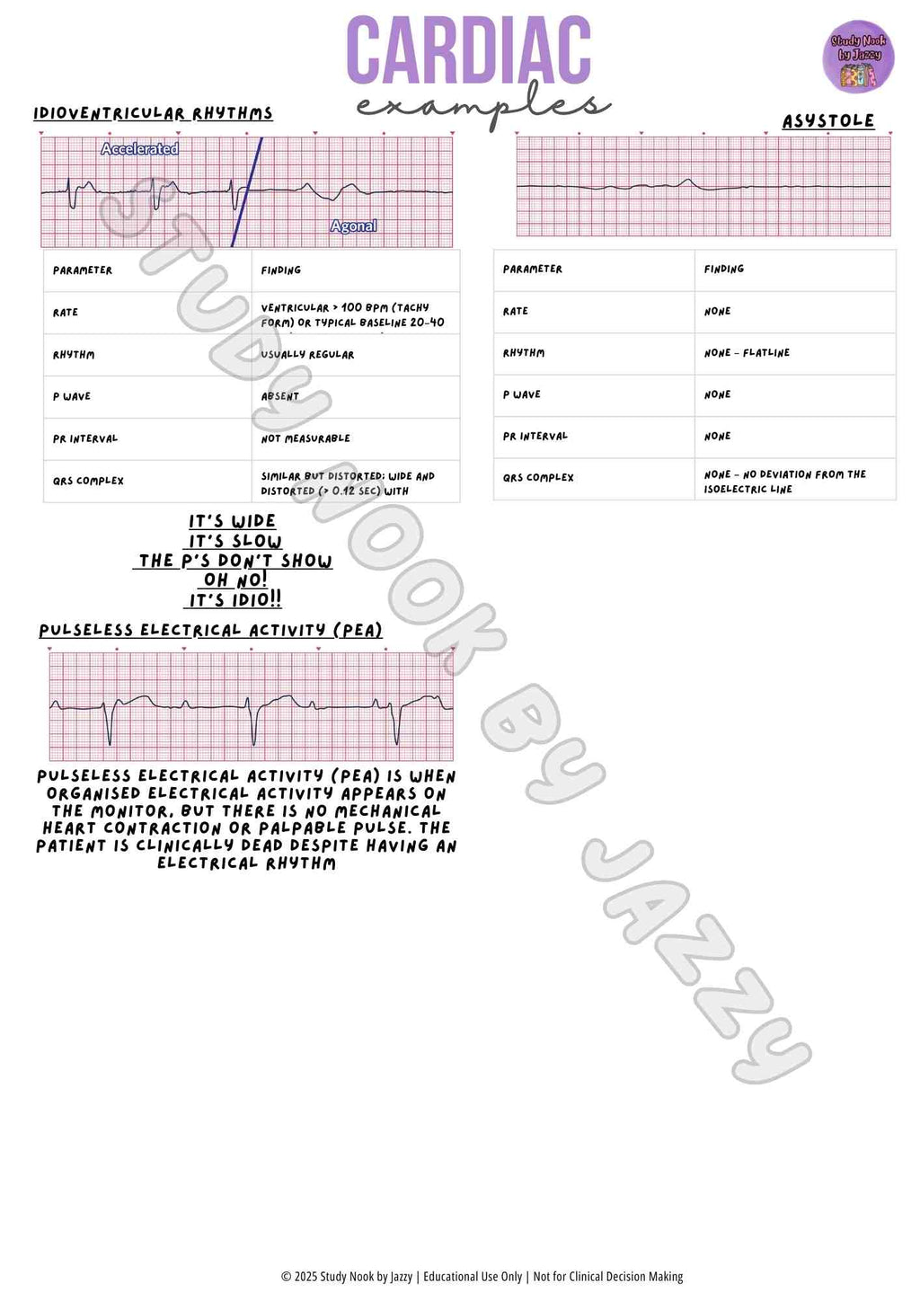 Advanced Cardiac Notes - ECG & ACS Study Guide